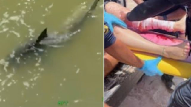 Shark attacks on July 4th harm 1 person in Florida and 3 in Texas